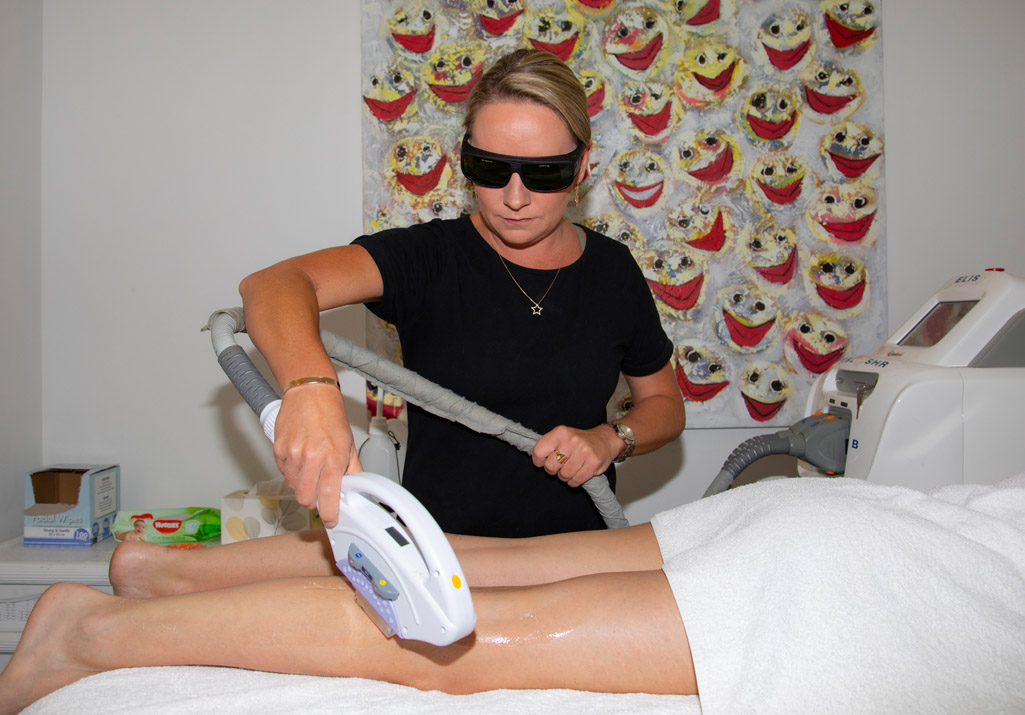 laser-hair-removal-2