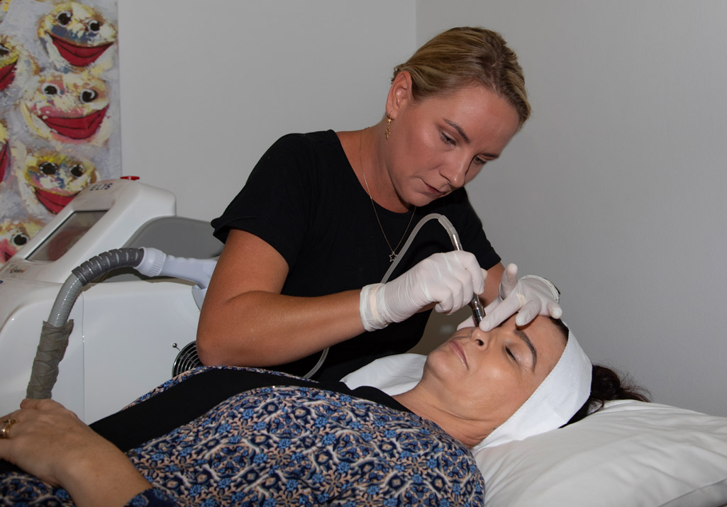 microdermabrasion-gold-coast-3