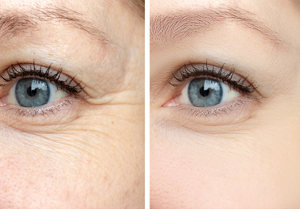 Skin treatment before and after